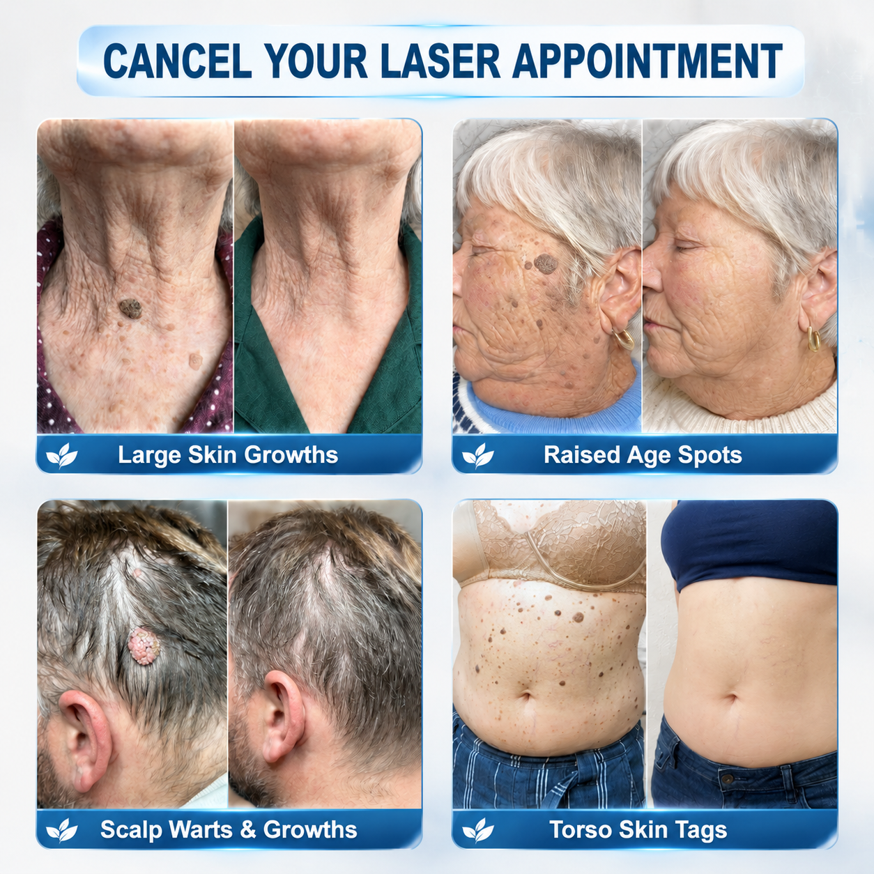 Dewvely® 7-𝐃𝐚𝐲 𝐒𝐤𝐢𝐧 𝐓𝐚𝐠 & 𝐒𝐩𝐨𝐭 𝐄𝐫𝐚𝐬𝐞𝐫 𝐂𝐫𝐞𝐚𝐦 (Pain-Free, Scar-Free Formula)
