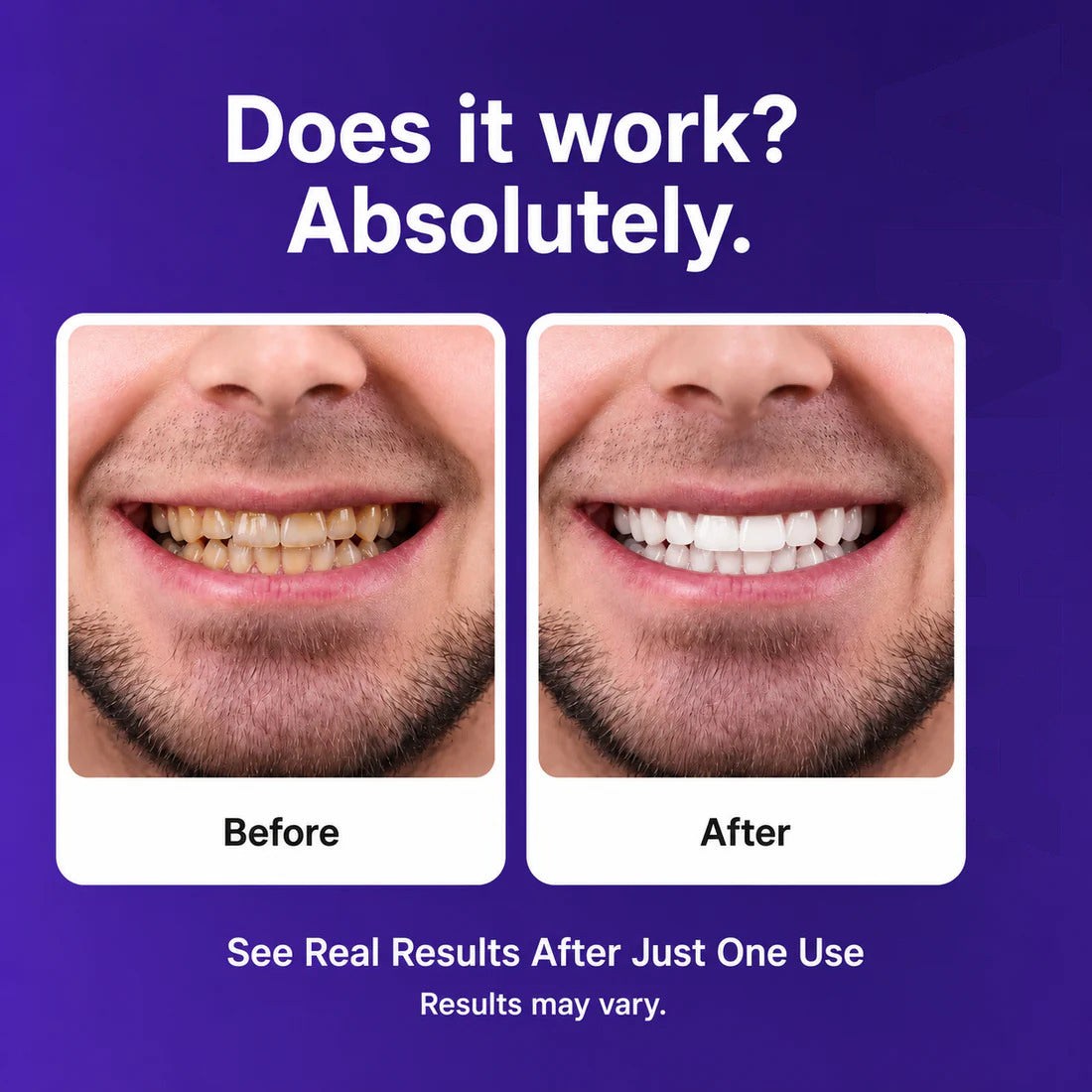 Dewvely Purple Teeth Whitening Strips