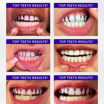 Dewvely Purple Teeth Whitening Strips