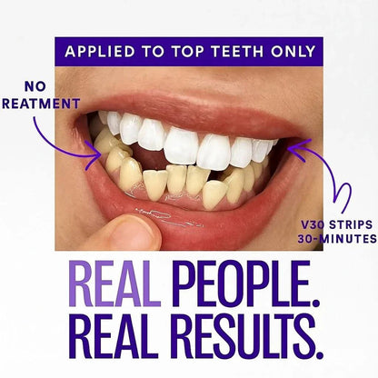Dewvely Purple Teeth Whitening Strips