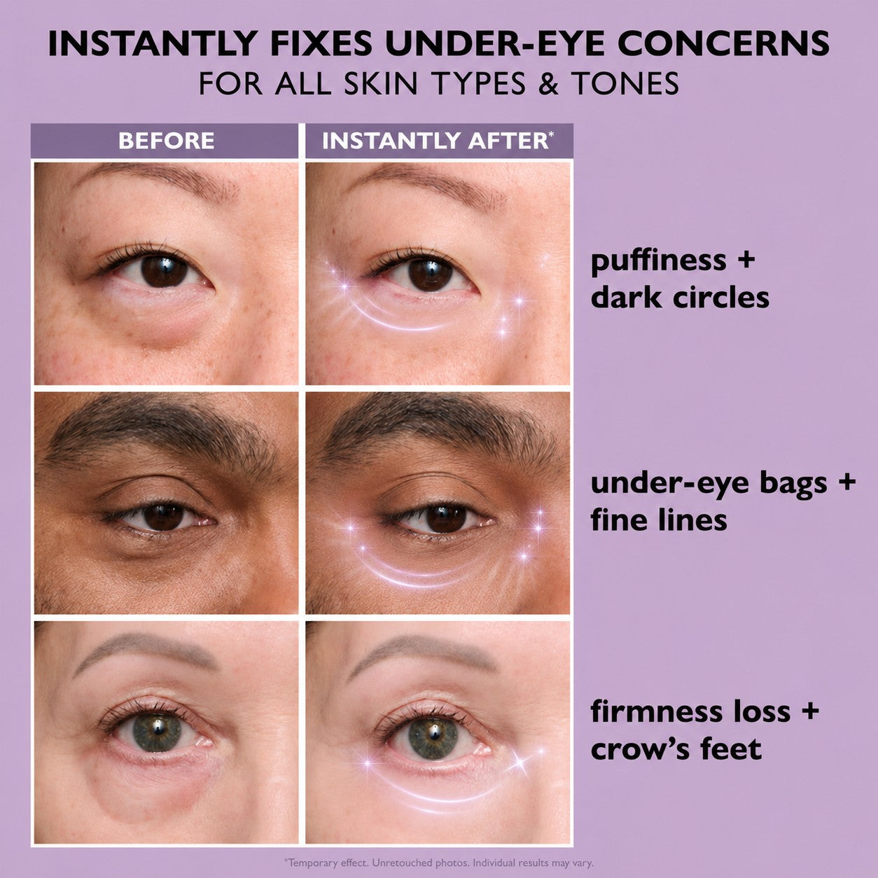 Eye Bag Instant Eraser, Tightens, Firms, & Blurs Wrinkles