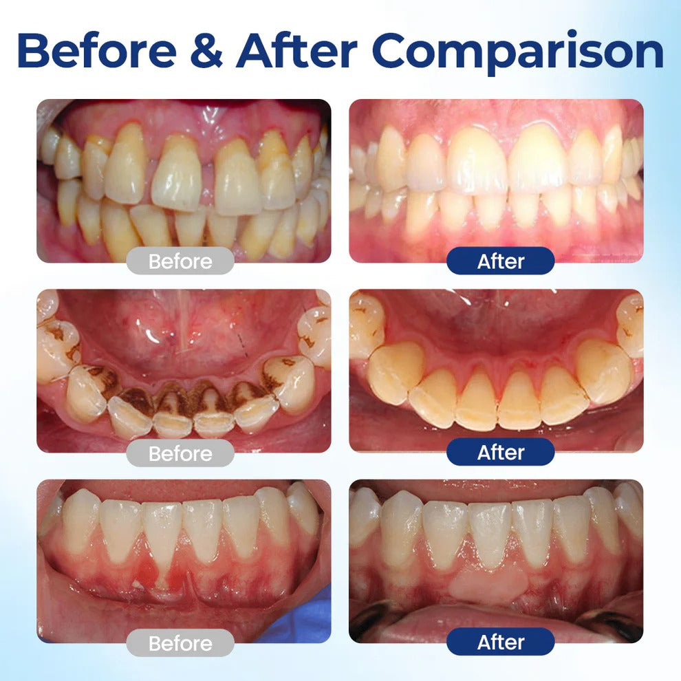 Dewvely BeeTakt Oral Repair Solution-sensitive teeth-Removes stubborn plaque and deep stains-Eliminates 99.9% of harmful bacteria