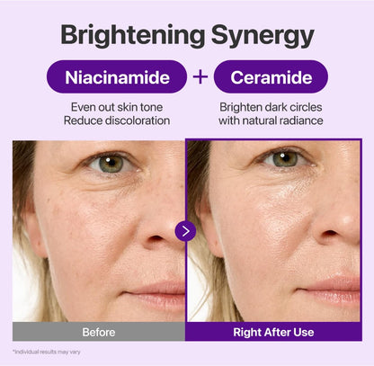 Dewvely  Eye Cream  Anti-Aging Treatment for Wrinkles, Fine Lines, Dark Circles & Dark Spots  Face to Body, Skin Longevity