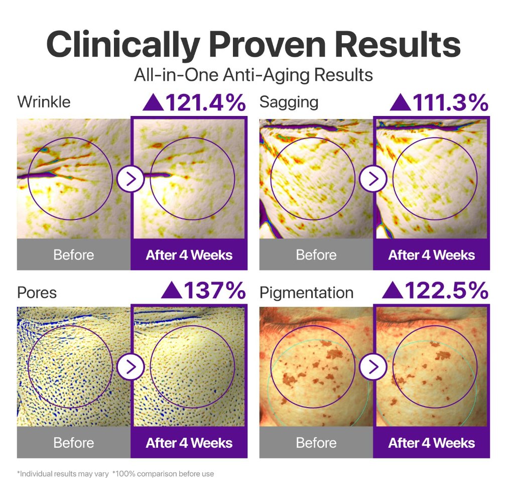 Dewvely  Eye Cream  Anti-Aging Treatment for Wrinkles, Fine Lines, Dark Circles & Dark Spots  Face to Body, Skin Longevity