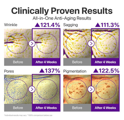 Dewvely  Eye Cream  Anti-Aging Treatment for Wrinkles, Fine Lines, Dark Circles & Dark Spots  Face to Body, Skin Longevity