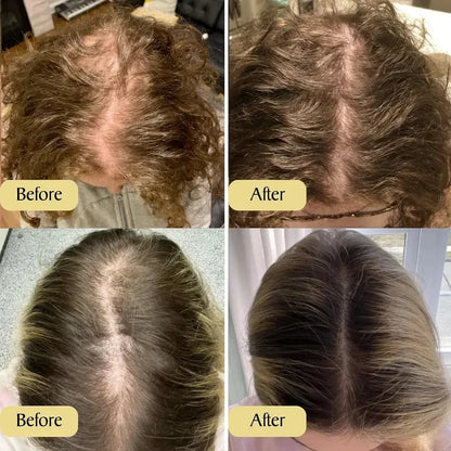 Dewvely Deoxyribose Scalp Serum | Korean Hair Care